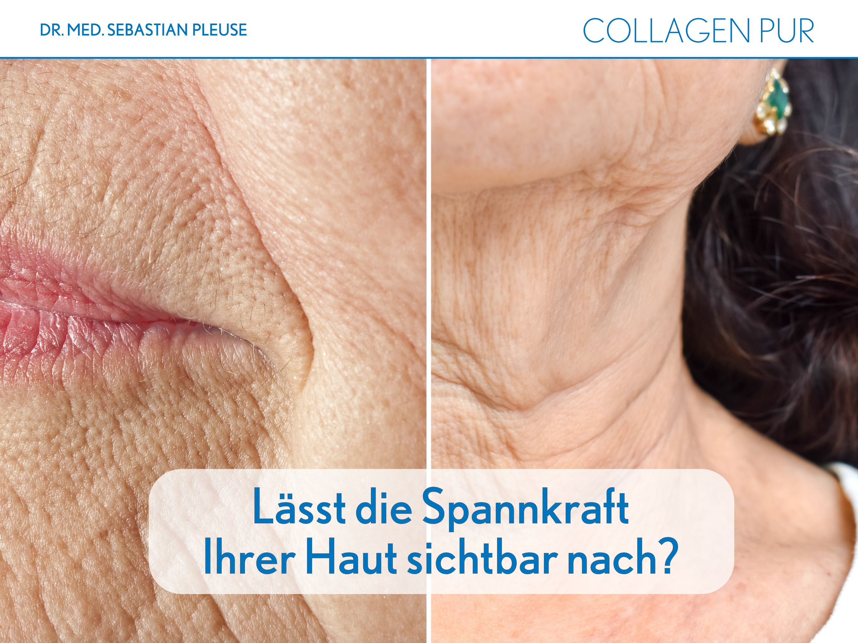 Collagen Pur DOPPELPACK (2 Monate)