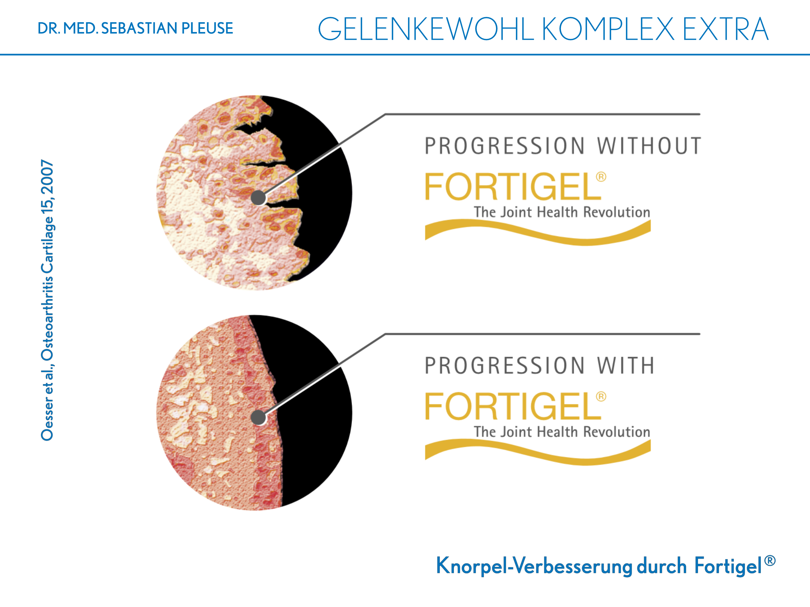 Gelenkewohl Komplex Extra Doppelpack (2 Monate)