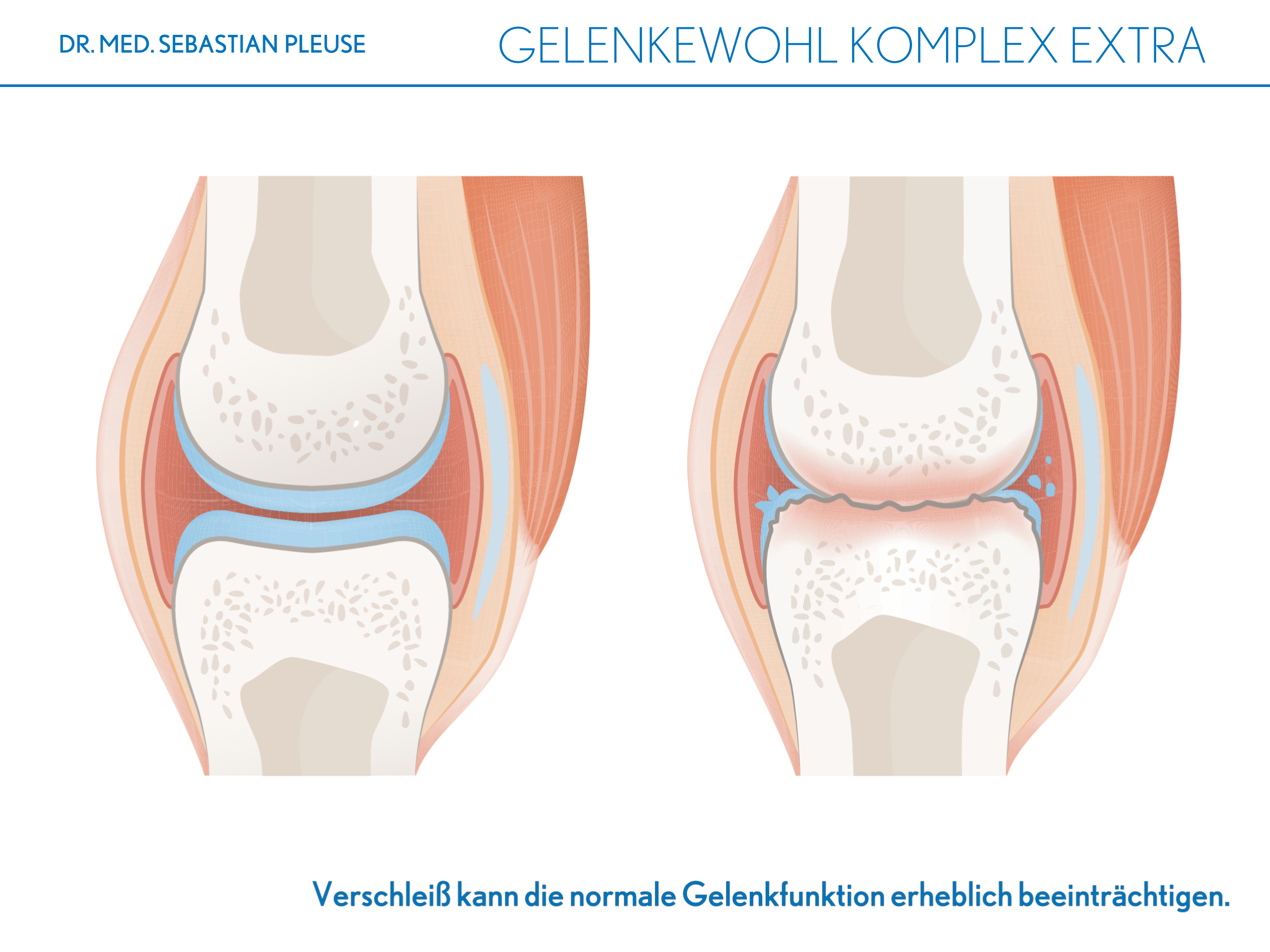 Gelenkewohl Komplex Extra Doppelpack (2 Monate)