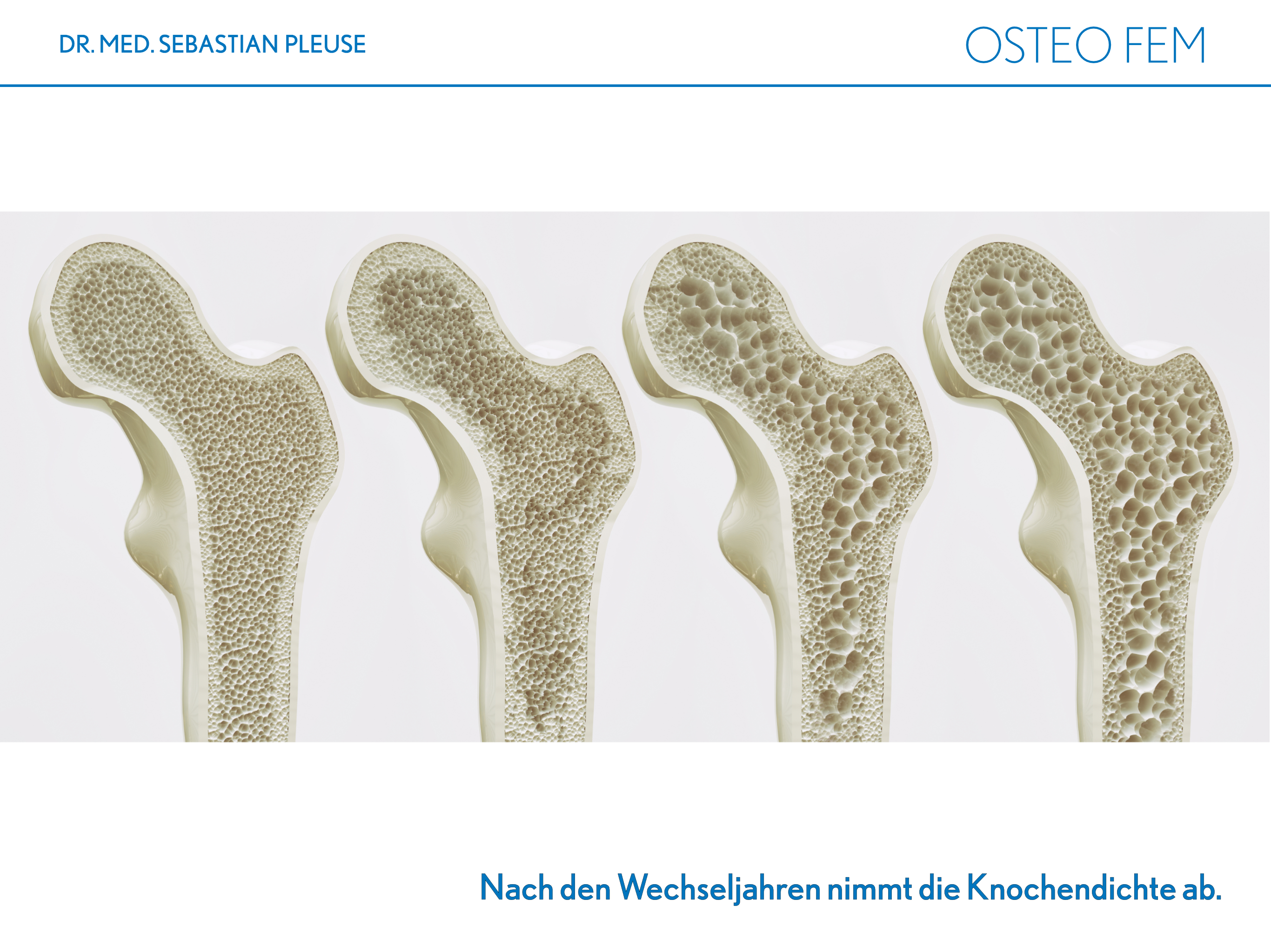 Osteo Fem DOPPELPACK (2 Monate)