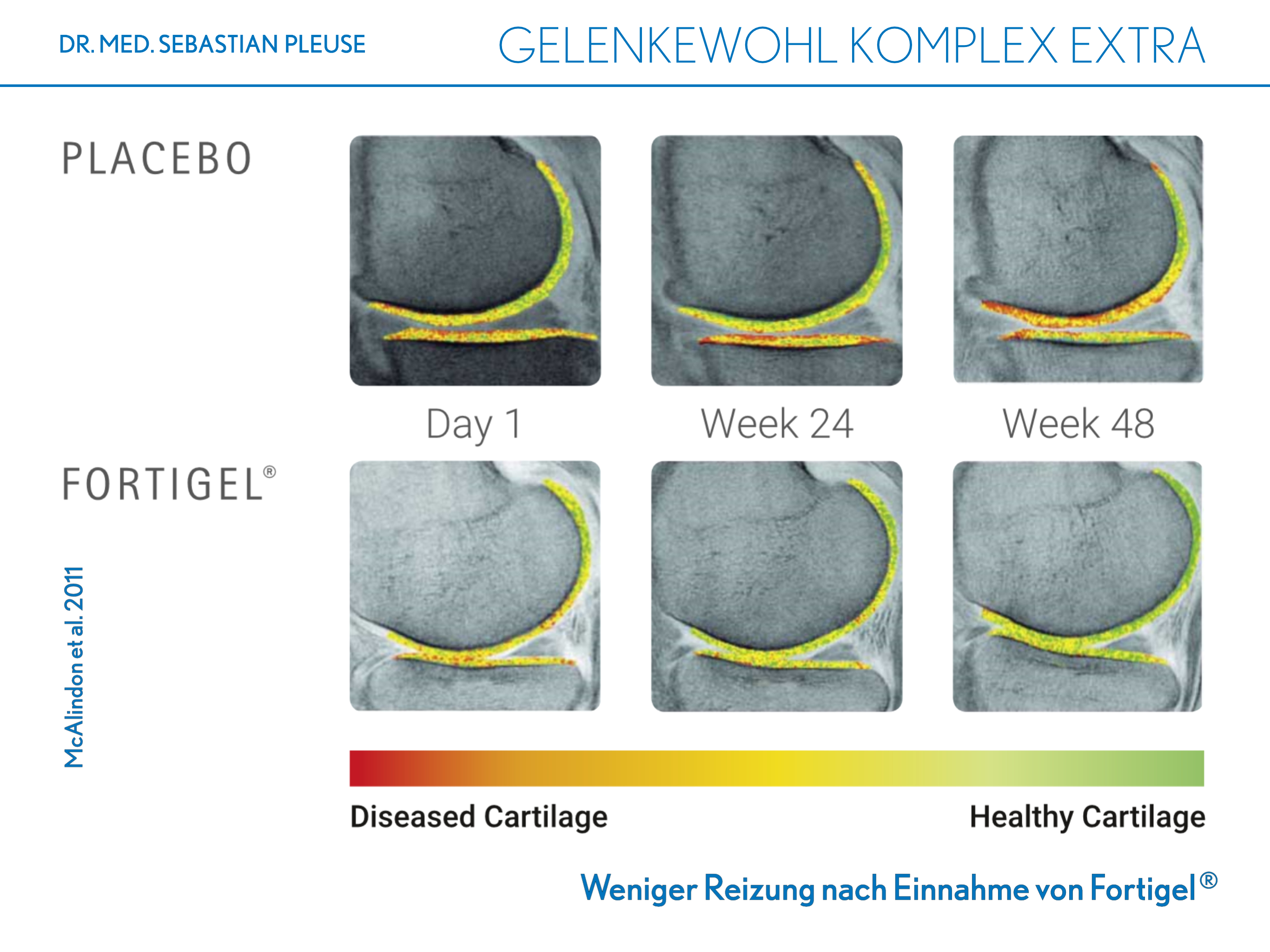 Gelenkewohl Komplex Extra Doppelpack (2 Monate)