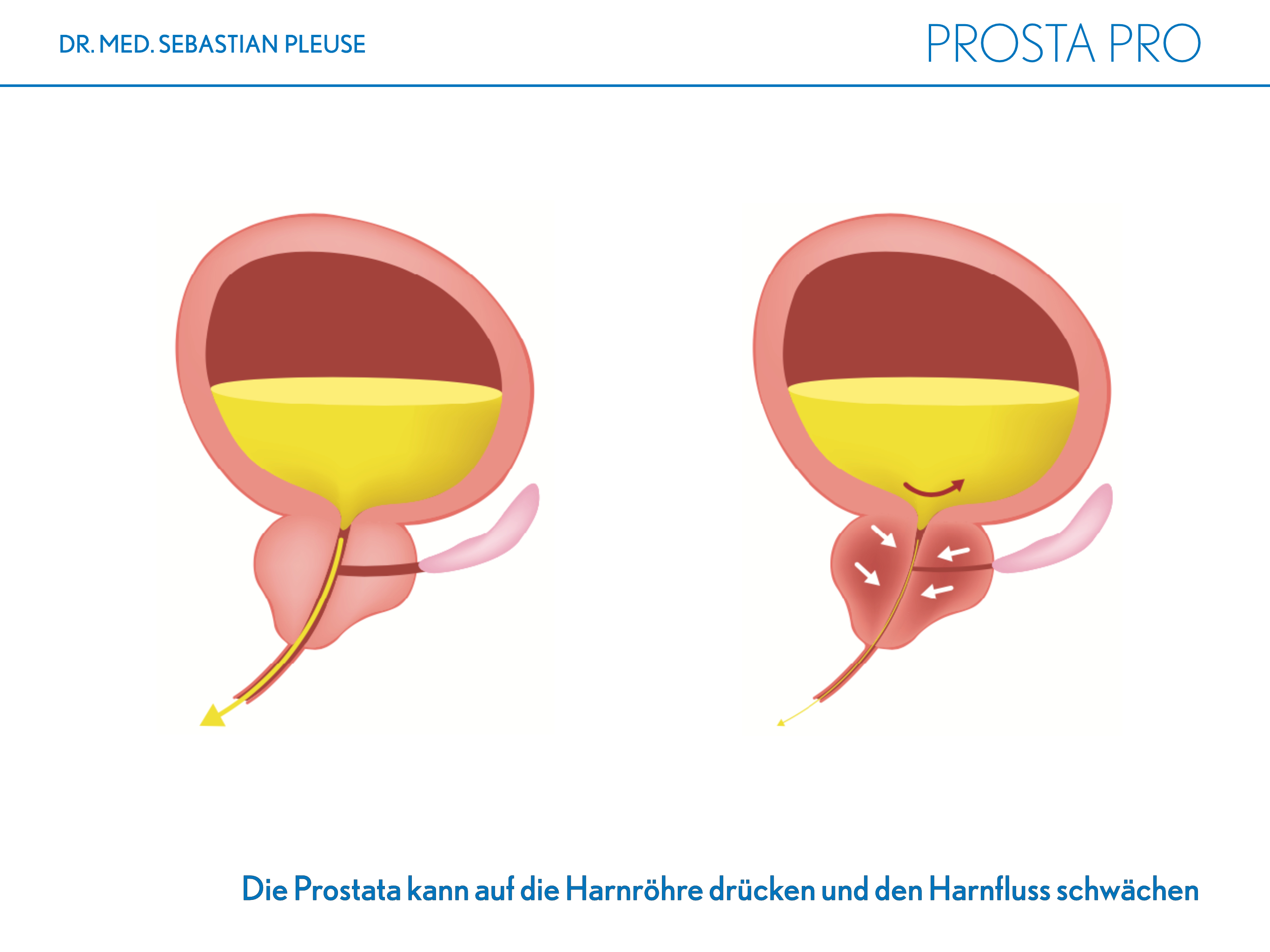 Prosta Pro (1 Monat)