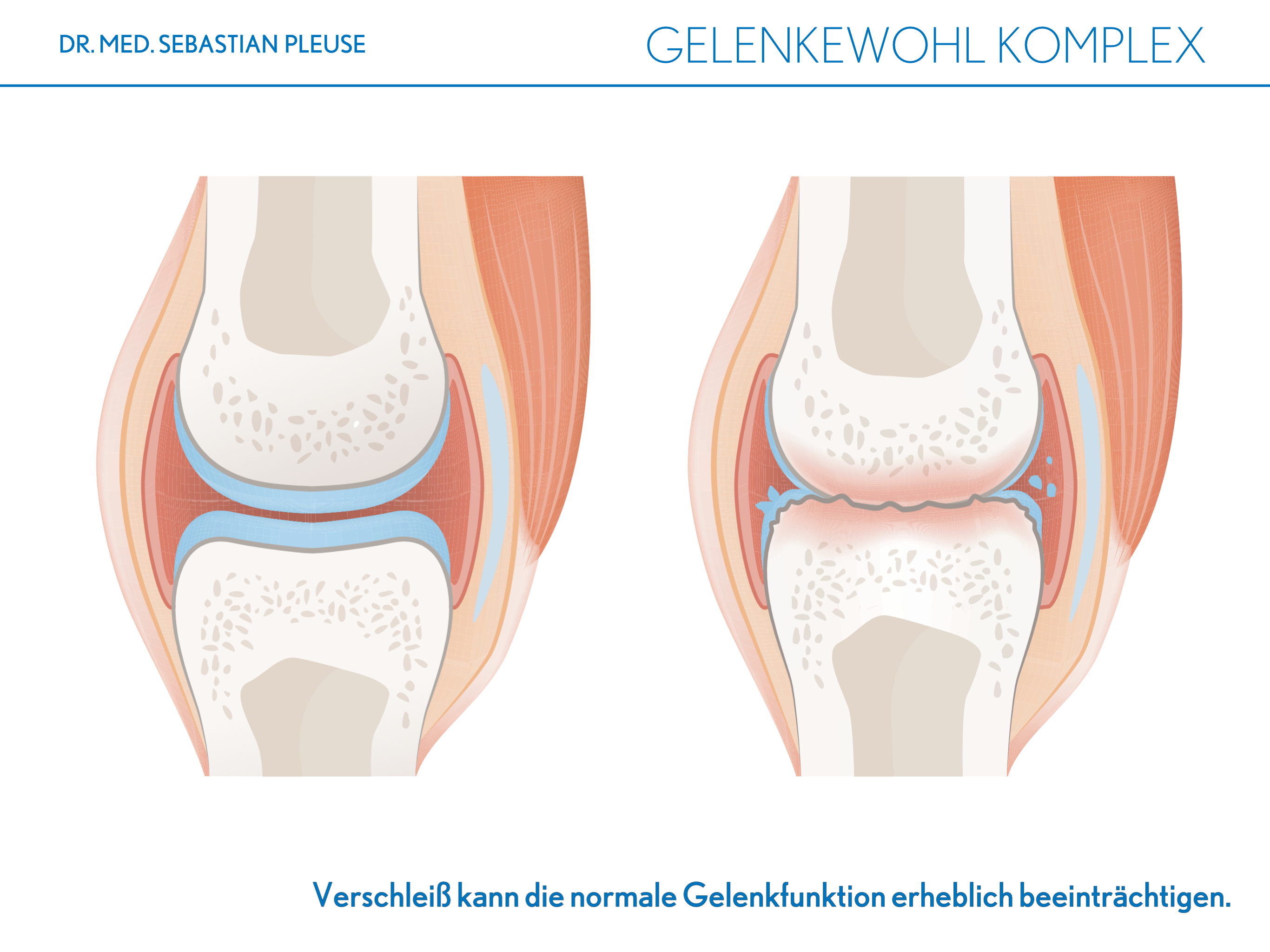 Gelenkewohl Komplex (1 Monat)