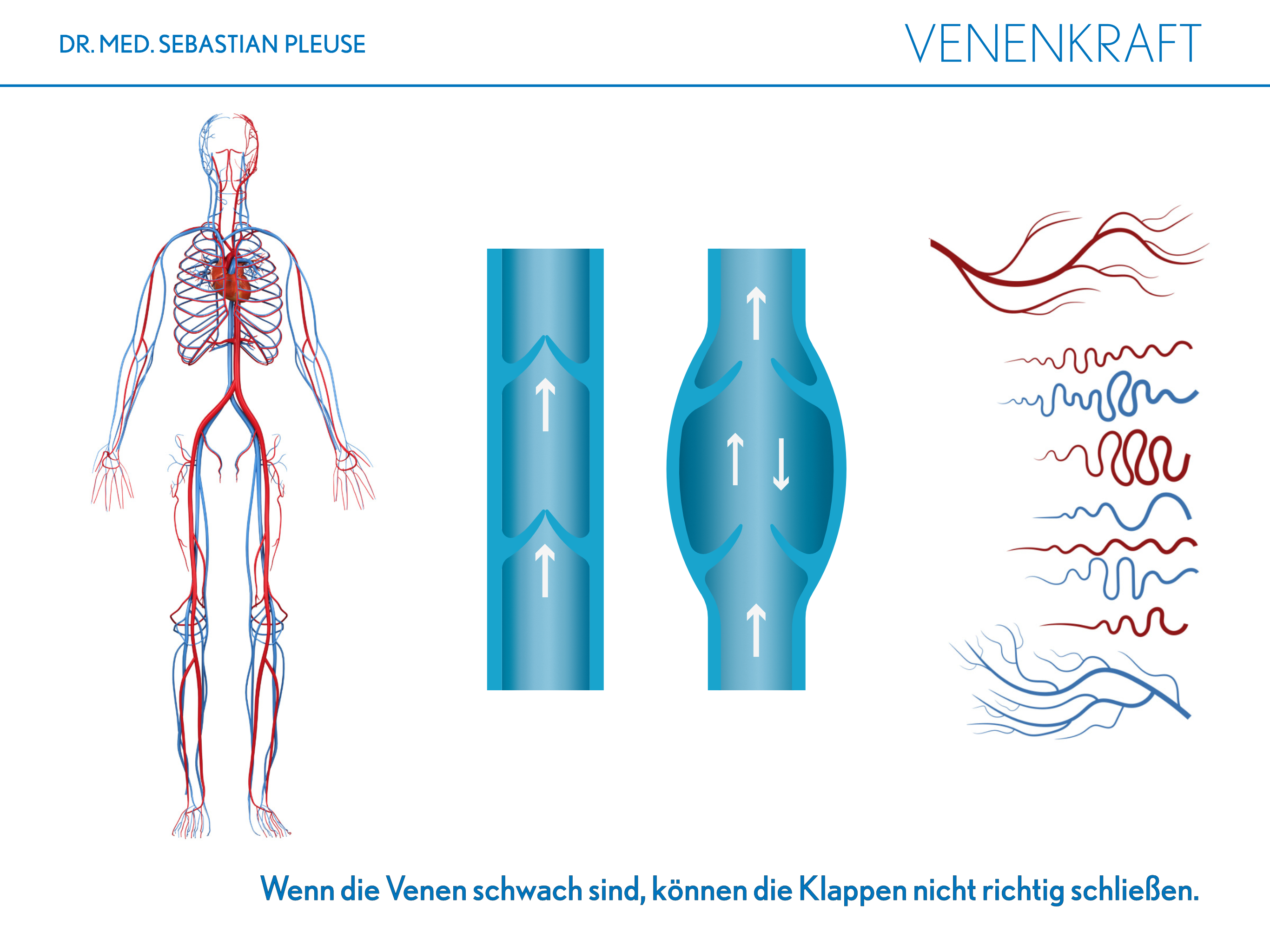 Venenkraft (1 Monat)