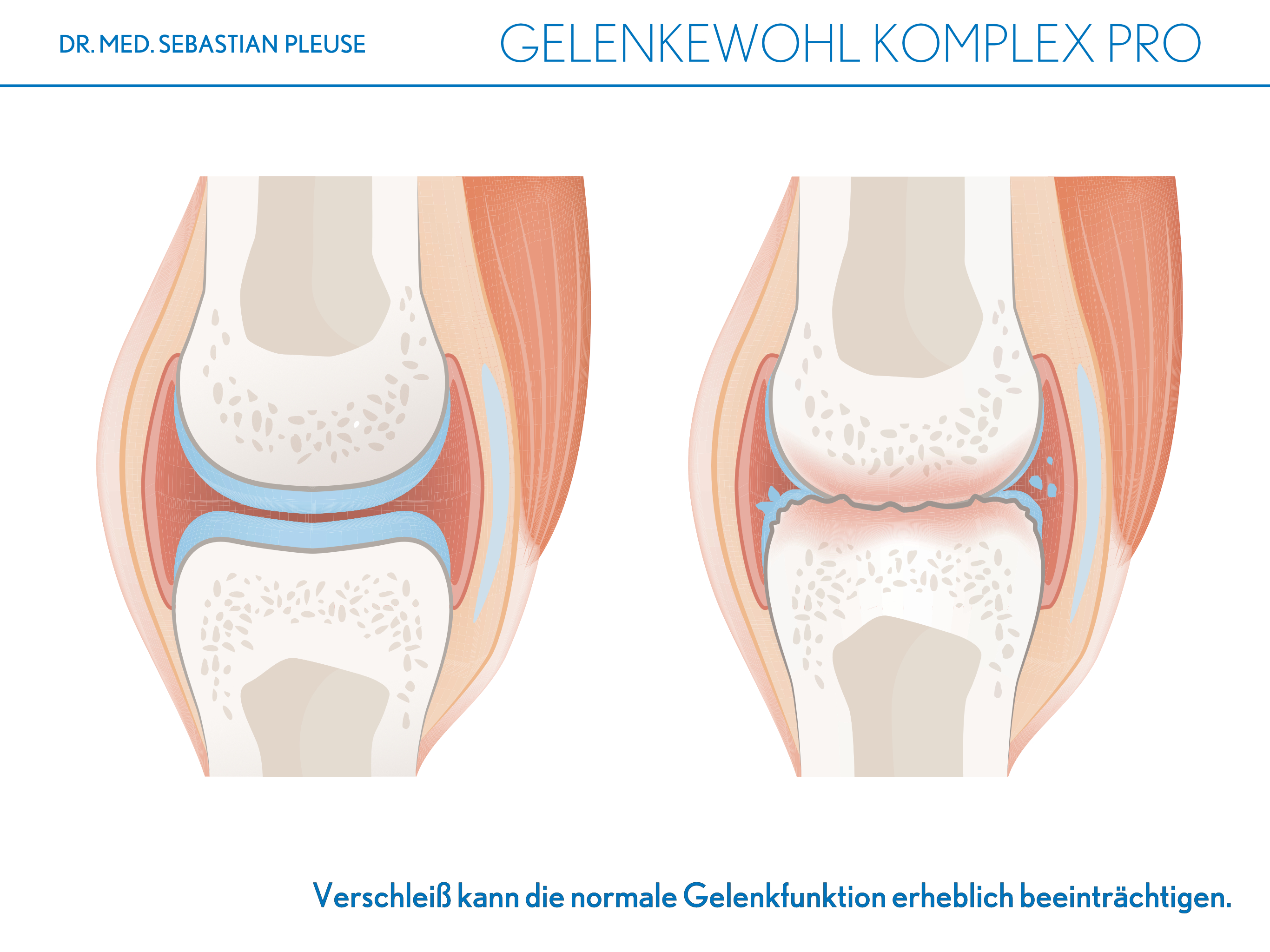 Gelenkewohl Komplex Pro DOPPELPACK (3 Monate)