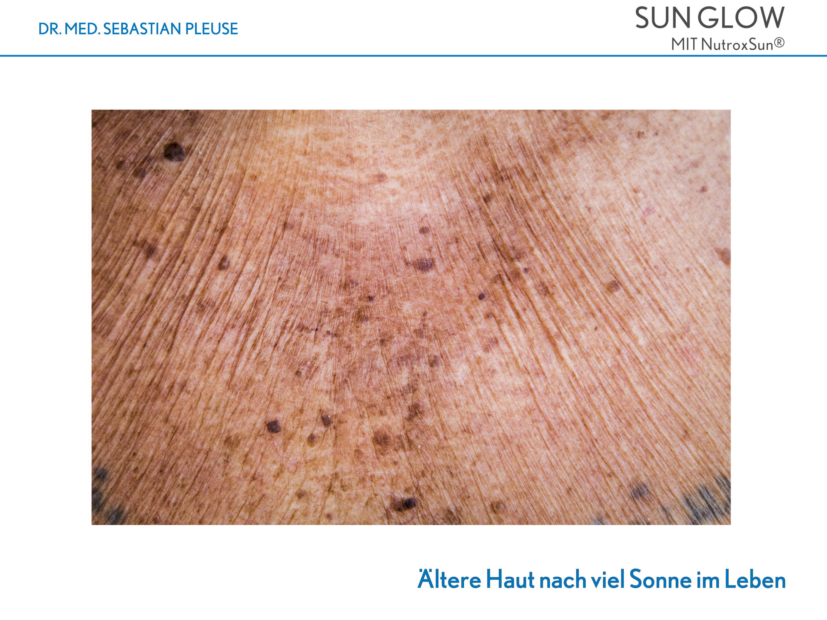 Sun Glow Doppelpack (4 Monate)