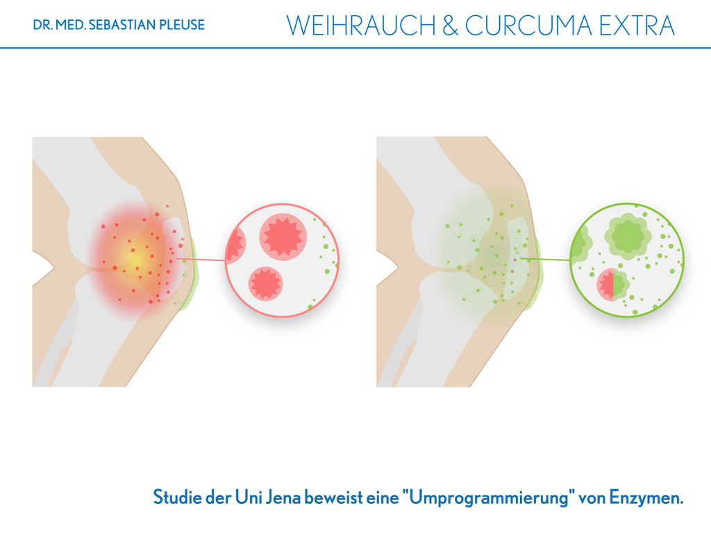 Weihrauch & Curcuma EXTRA (3 Monate)