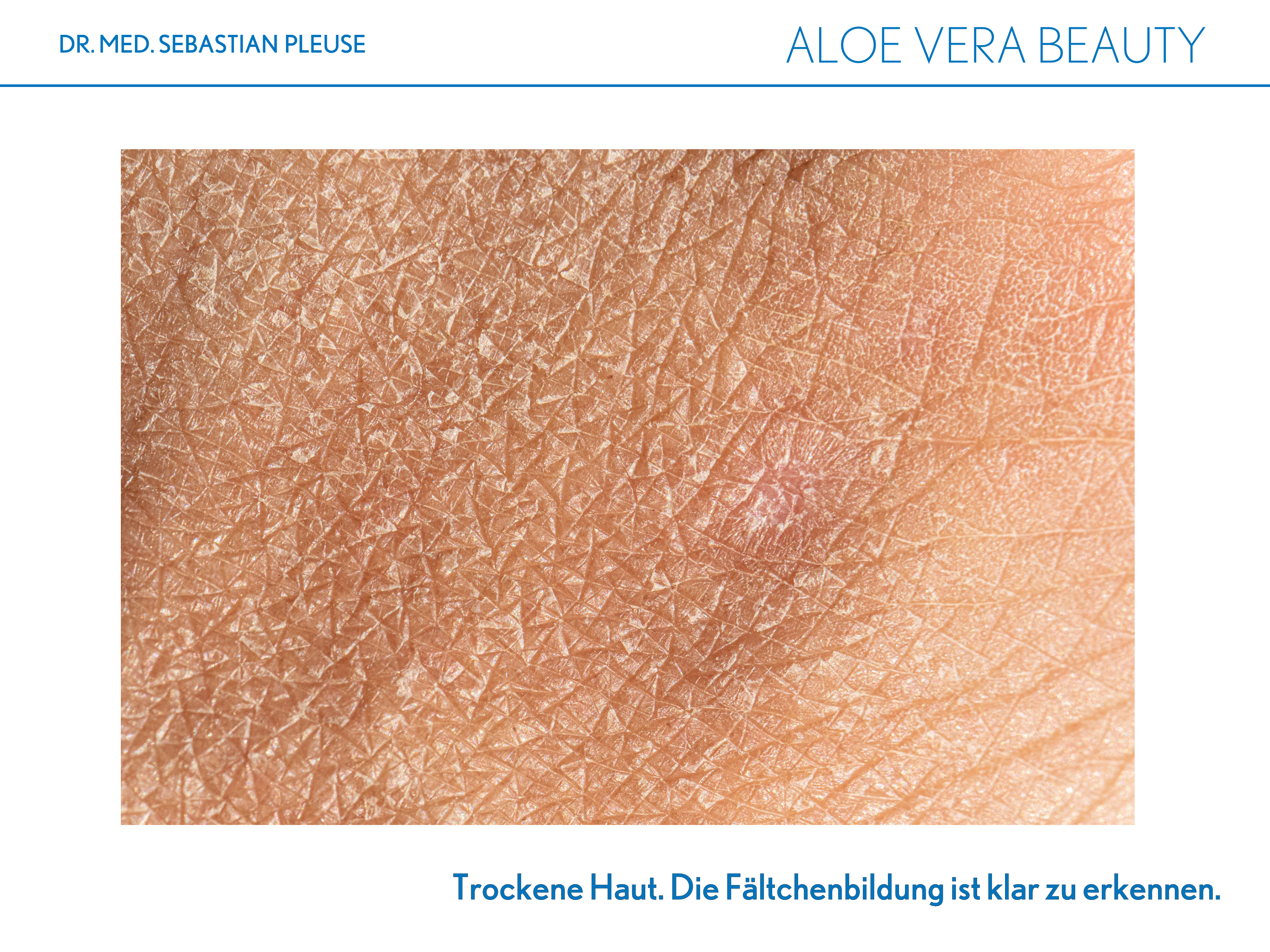 Aloe Vera Beauty (1 Monat)