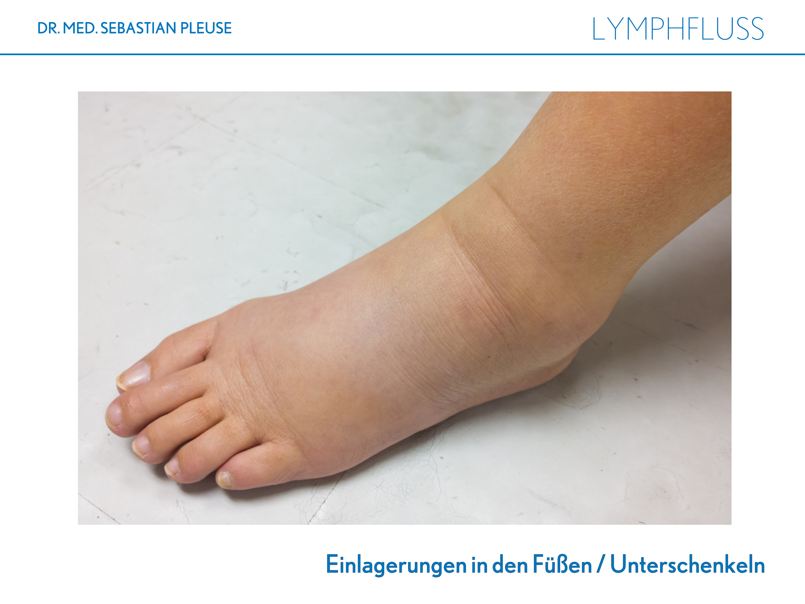 Lymphfluss (1 Monat)