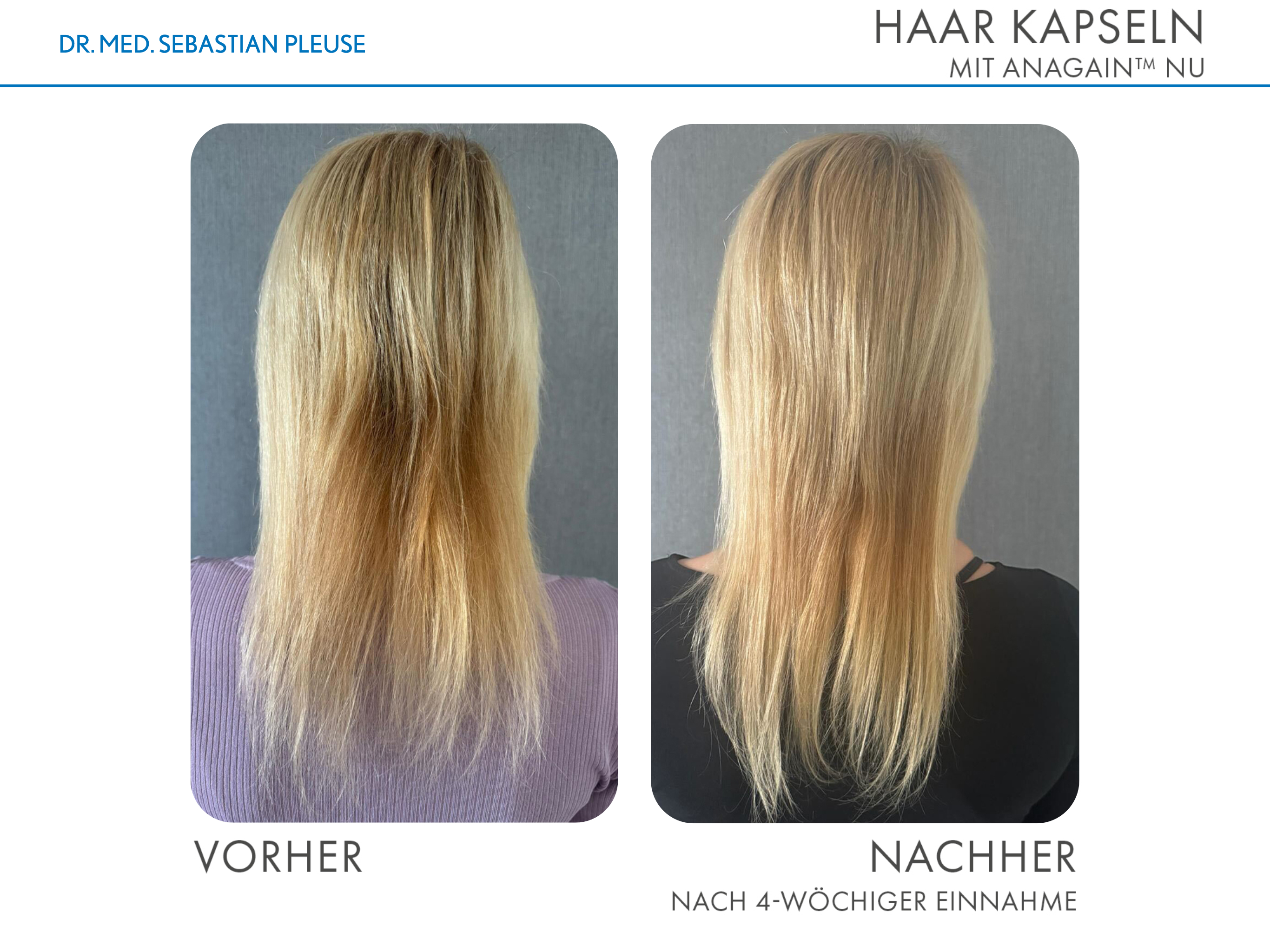 Haar Kapseln (1 Monat)